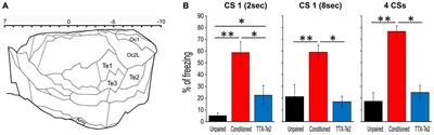 Reversible Inactivation of the Higher Order Auditory Cortex during Fear Memory Consolidation Prevents Memory-Related Activity in the Basolateral Amygdala during Remote Memory Retrieval